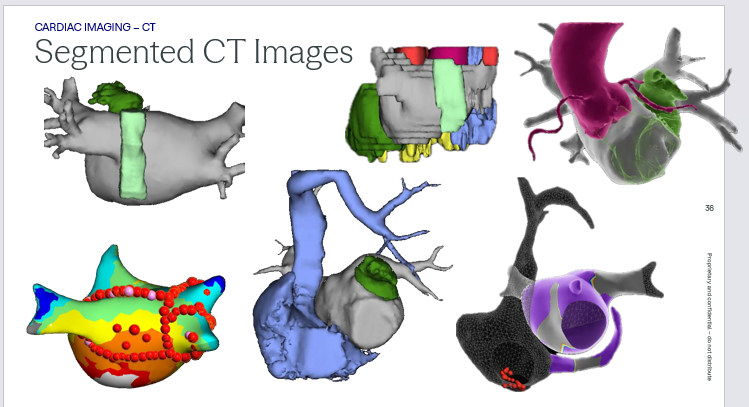 <ul><li><p>cross sectional slices are digitally stacked together to form a 3D image of the patient’s heart </p></li><li><p>benefits: provides detailed patient anatomy prior to the case/ catheter placement </p></li><li><p>limitations: relies on radiation and contrast </p></li><li><p>static image of a dynamic structure</p></li><li><p>uses gating to image at one portion of the cardiac cycle</p></li><li><p>slice thickness and spacing determine image resolution </p></li></ul><p></p><p>Scanning Planes </p><p>Coronal: divides structure from front to back</p><p>Transverse: divides the structure into upper and lower portions perpendicular to the long axis </p><p>Sagittal: divides structure vertically through the long axis creating right and left </p><p></p>