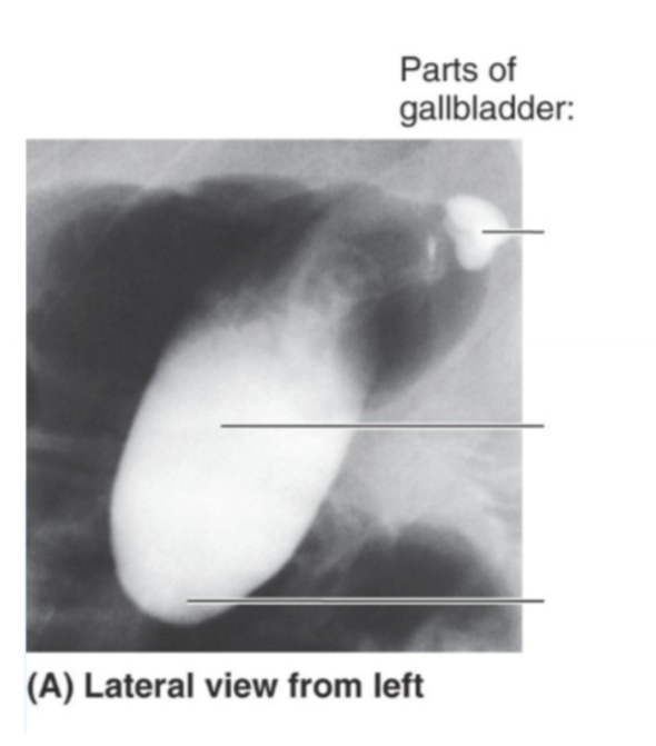 <p>Please label parts of the gallbladder </p>