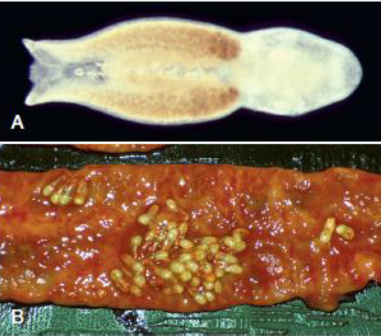 <p>Name this Trematode: Where does it live and in what hosts?</p>