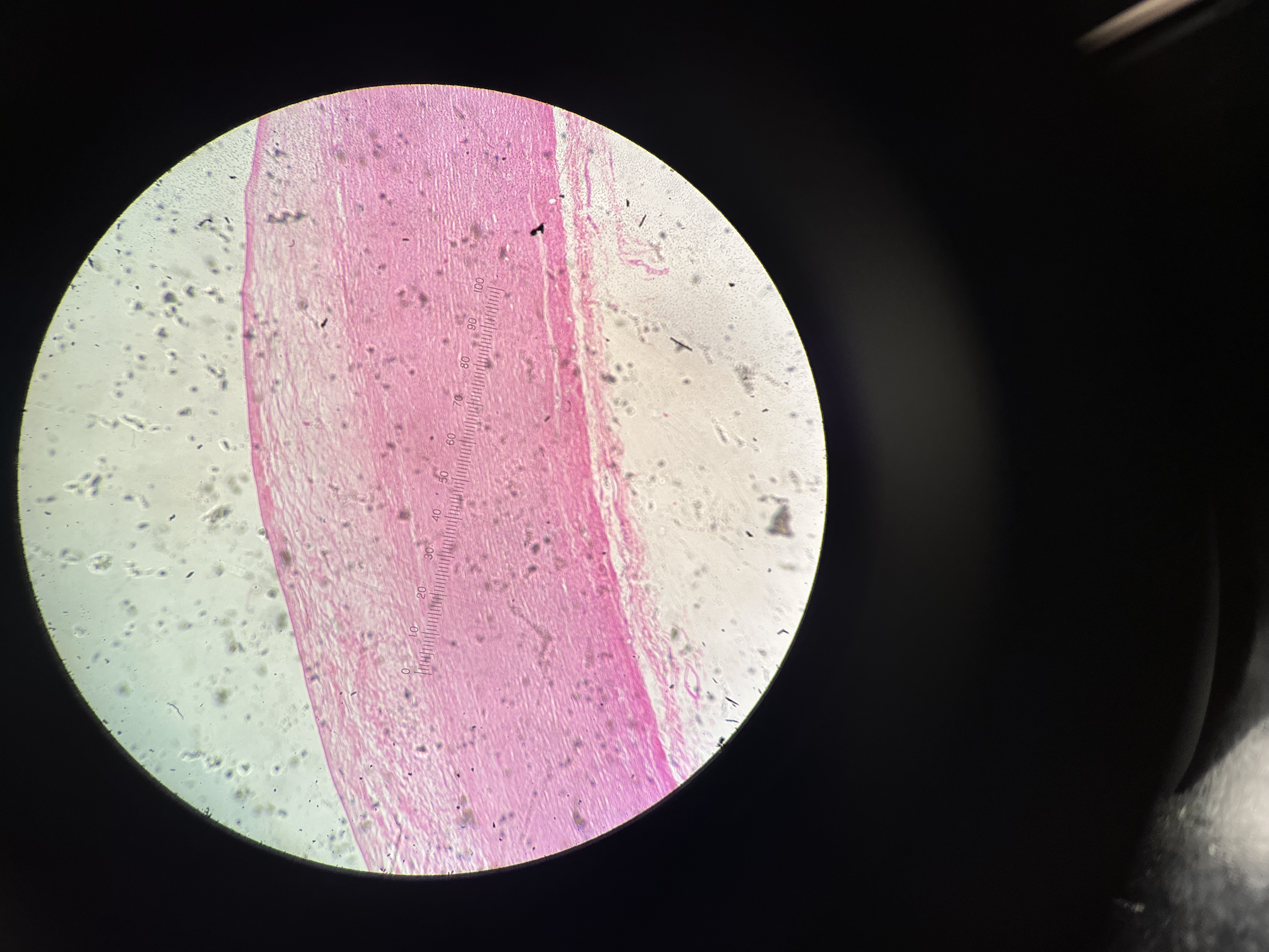 <p>Human Atherosclerosis aorta section </p>