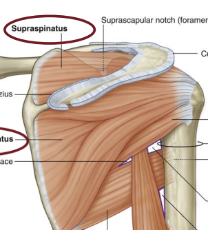 <p><span style="background-color: transparent;"><strong>Rotator Cuff Muscle:</strong> Supraspinatus</span></p>