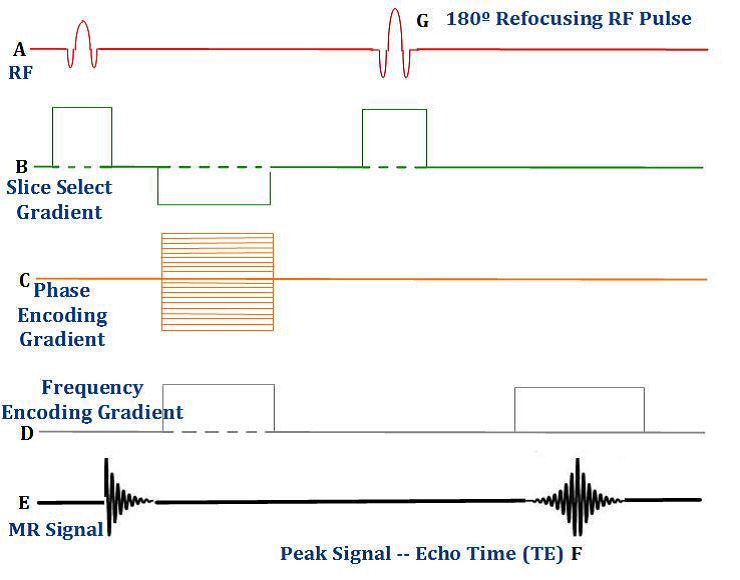<p>What type of pulse sequence is this ?</p>