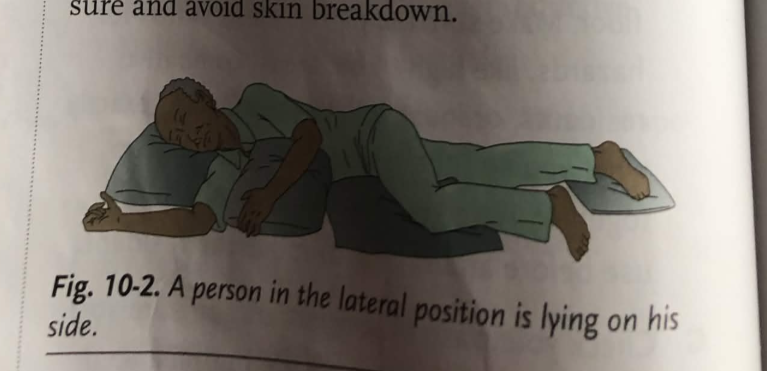 <p>A resident in lateral position is laying on either side, and there are many variations of this position</p>