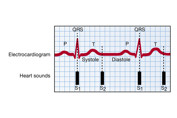 <p><span>count the apical pulse while a 2nd person simultaneously counts the radial pulse for 1 full minute</span></p>