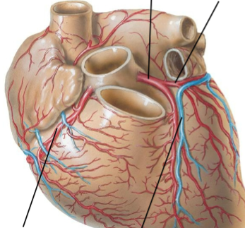 <p>Bottom right</p>