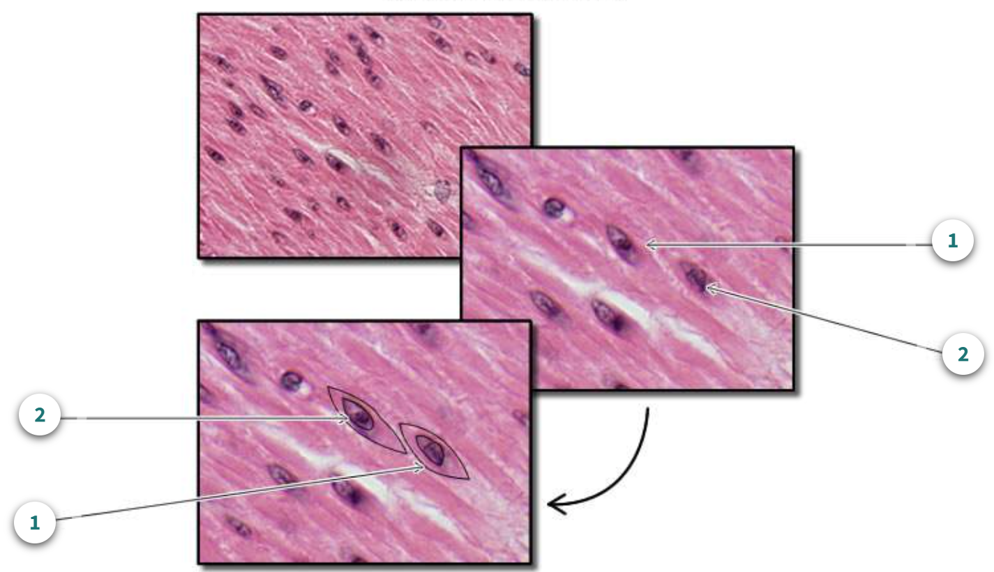 <p>Number 2; What is the marking called?</p>