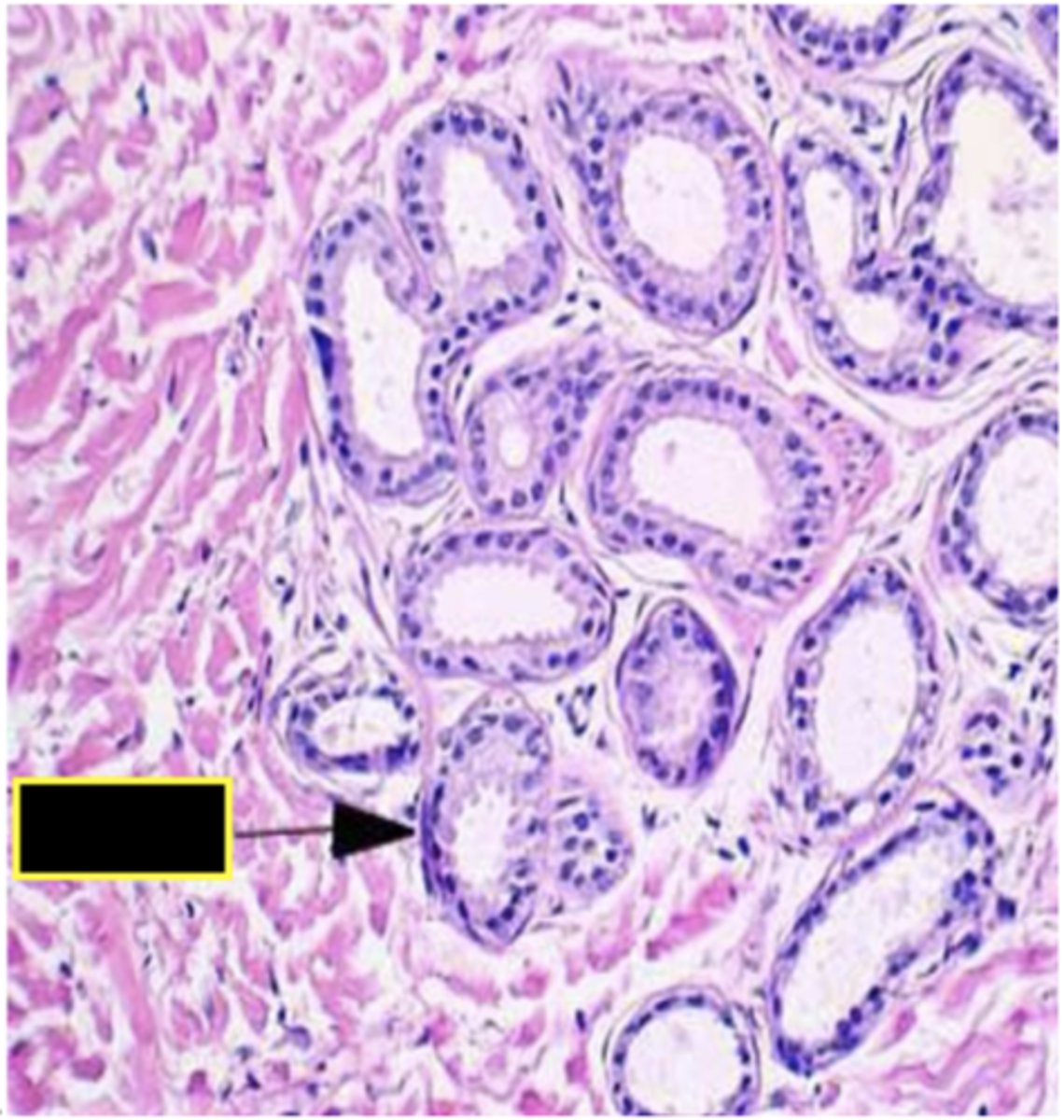 <p>Identify the structure</p>
