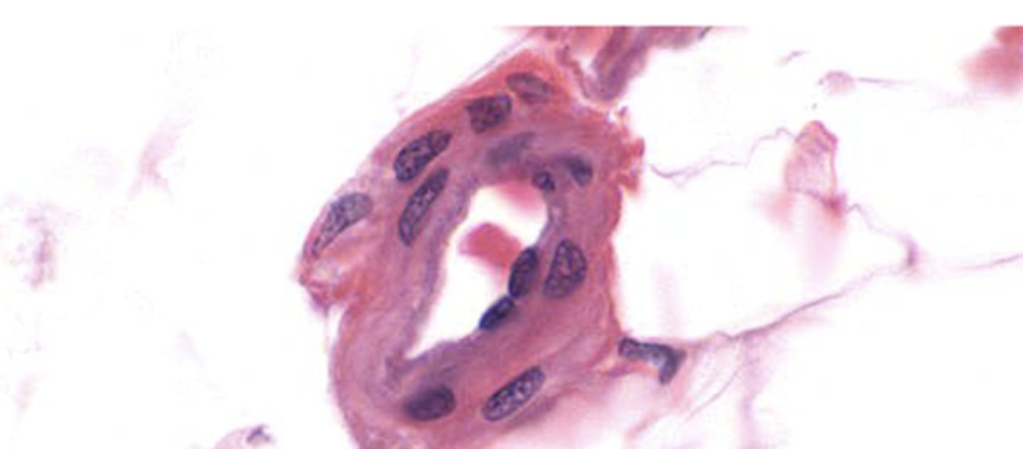 <p>Identify the type of vessel</p>