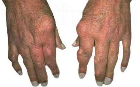 <p>What pathology is shown?</p>