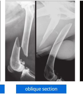 <p>oblique section</p>