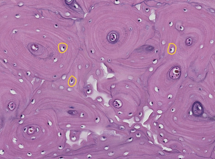 <p>this is the diaphysis (shaft) of a long bone in a transverse (cross) section. ID the encircled region of the osteon</p>