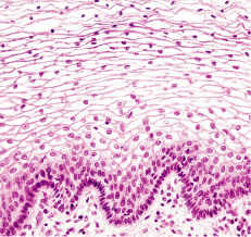 <p>many cell layers</p><p>look at apical surface of tissues</p>