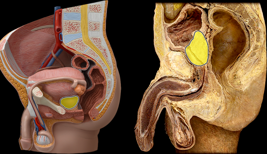 <p>What part of the male pelvis is this</p>