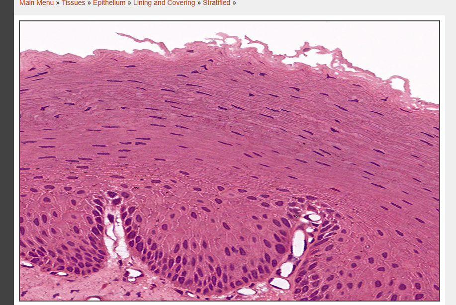 <p>what tissue type is this </p>