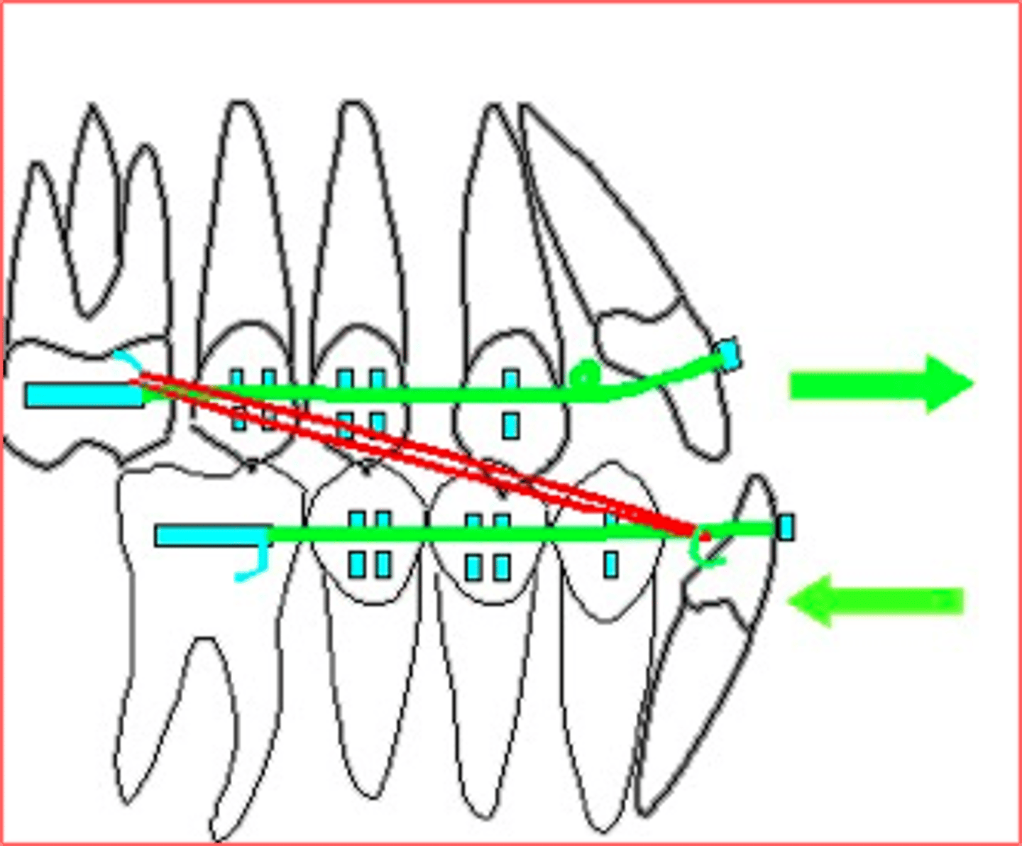 <p>ID the elastics class:</p>