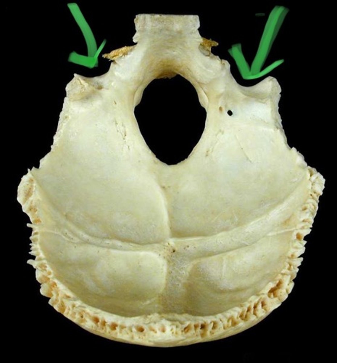 knowt flashcard image