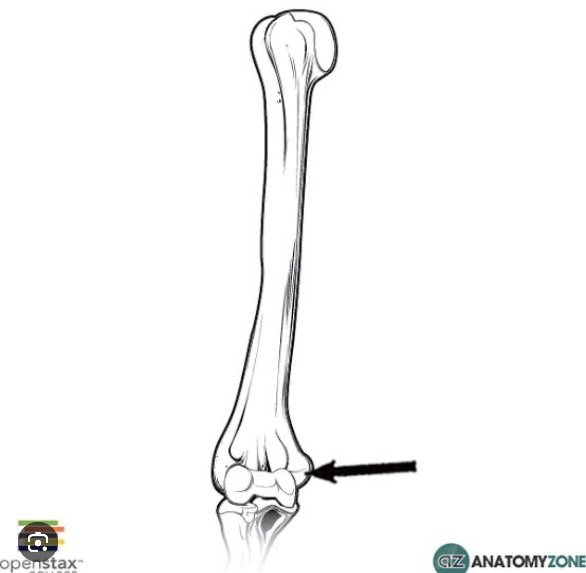 <p>Ulna/pinky side</p>