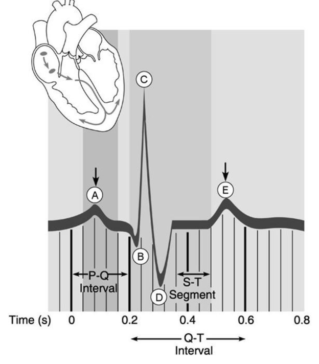 <p>Point that represents the "dup" sound made by the heart.</p>