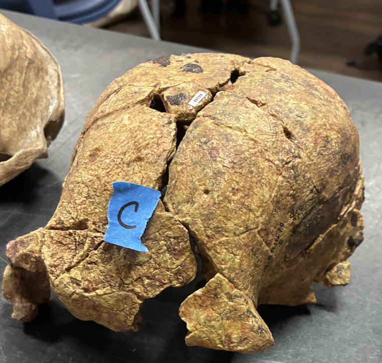 <ul><li><p>large brain (600cc)</p></li><li><p>smaller teeth (indicative of dietary shift - more generalized)</p></li><li><p><em>Australopithecus</em>-like body</p><ul><li><p>< 4 ft tall</p></li><li><p>long arms and short legs</p></li></ul></li></ul><p></p>