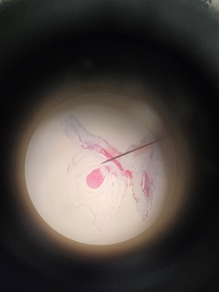 <ol><li><p>what is the phylum?</p></li><li><p>what structure is this?</p></li><li><p>what is the ploidy of the capsule? </p></li><li><p>what are the ploidy of the spores?</p></li></ol><p></p>