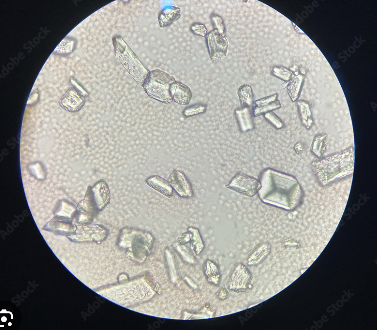 <p>What urinary crystal is this?</p>