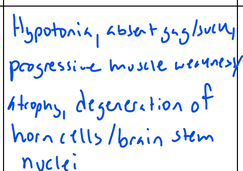 <p>Arthrogryposis multiplex congenita, peripheral nerve hypomyelination; muscle weakness, tongue fasciculations, absent DTRs</p>