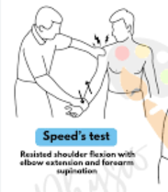 <p>Hold the arm straight out in front with the palm facing up. Someone pushes down while you try to hold it up. Pain in the front of the shoulder is positive.</p><p>biceps tendon subluxation</p>