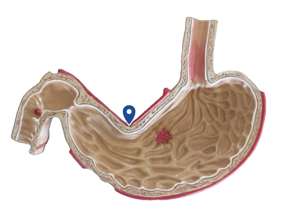 <p>Name this surface of the stomach.</p>