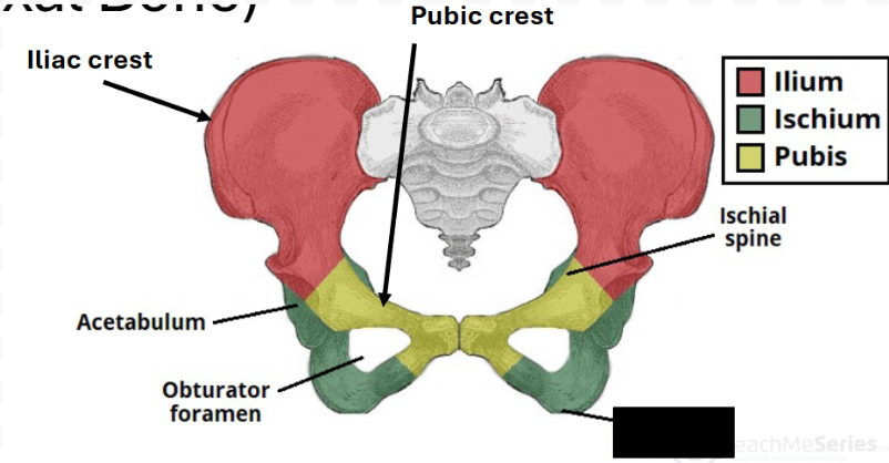<p>What part of coxal bone (hip) is this?</p>