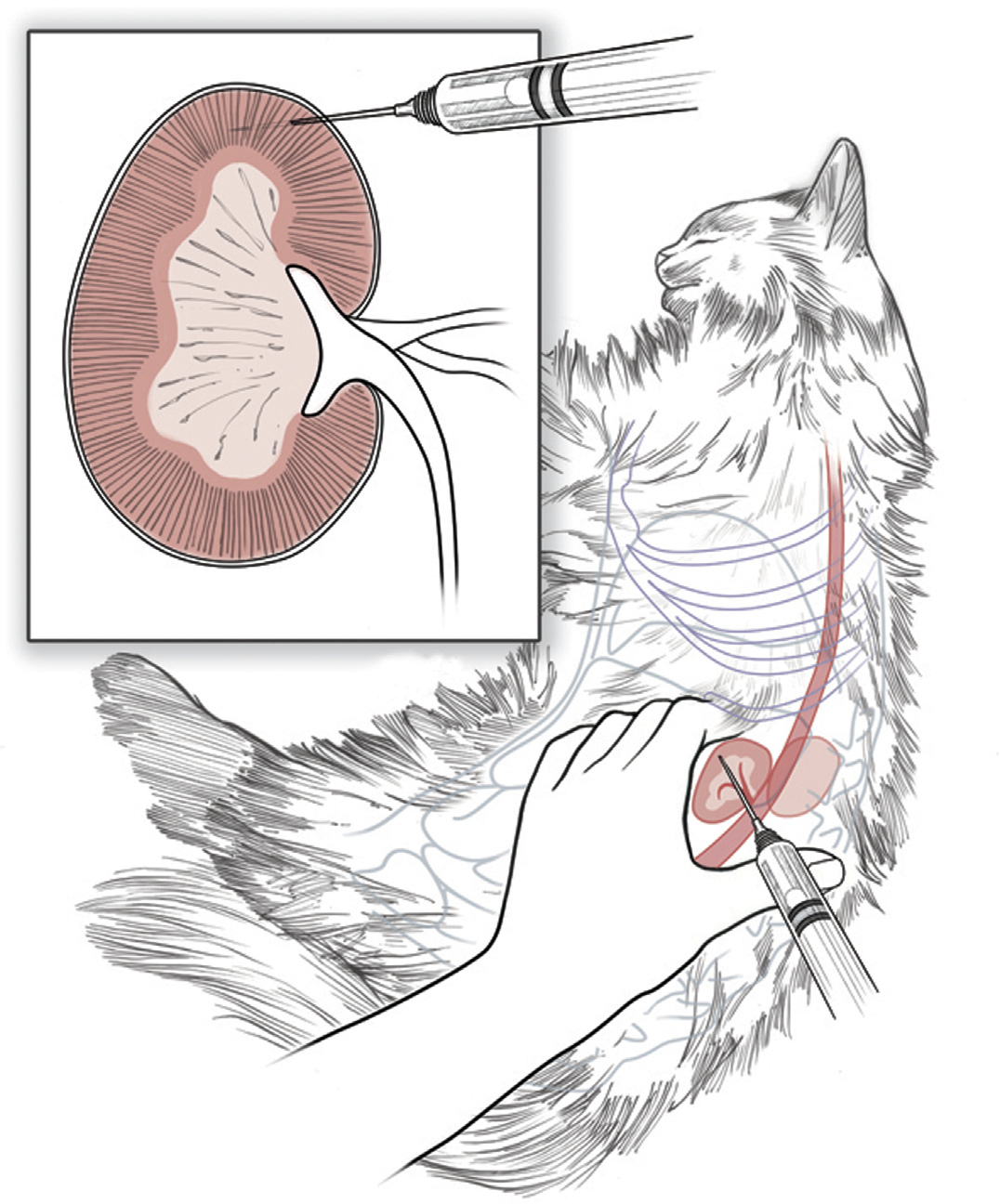 <p>Used in cats and small mammals</p><p></p><ul><li><p>Need a needle size of 5/8th of an inch</p></li><li><p>Choose the kidney that is easiest to isolate </p><ul><li><p>Easily palpated in cats just behind the last rib </p></li></ul></li><li><p>IS PAINFUL </p></li><li><p>Larger dose required </p></li></ul><p></p>