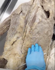 <p>Name the Muscle</p>
