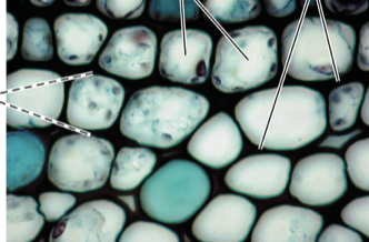 <p>Are these parenchyma or collenchyma cells?</p>