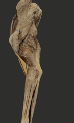 <p>What muscle is highlighted in the picture?</p>