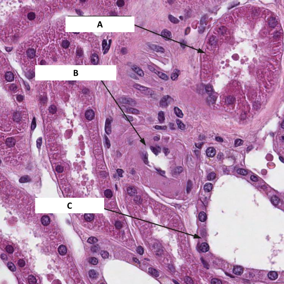 <p>Name the structure indicated by B.</p>