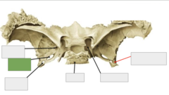 <p>This is the</p>