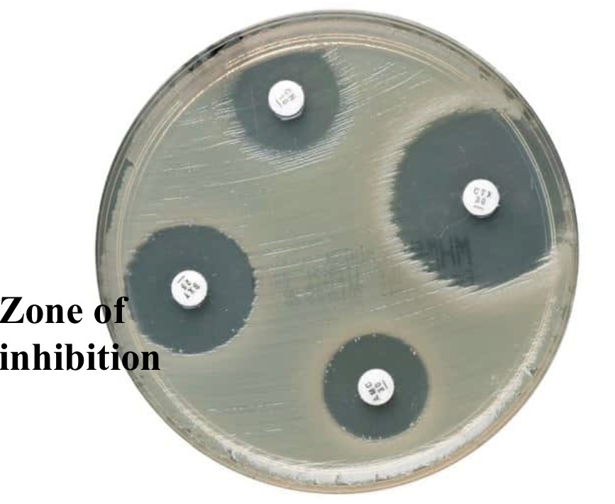 <p>Kirby-Bauer test</p>