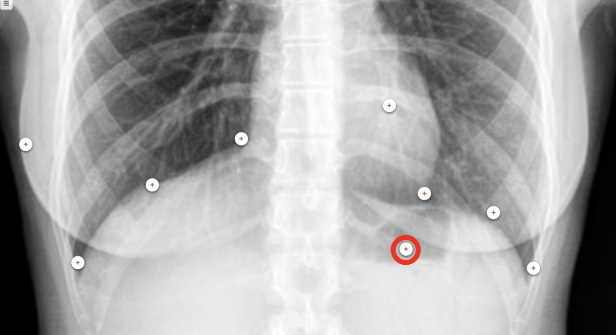 <p>what structure is the red circle labeling?</p>