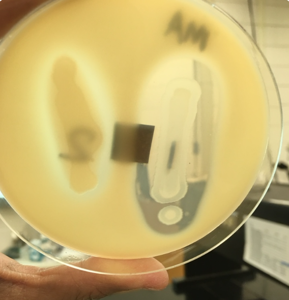 <p>A bacterium is grown on skim milk agar as shown below. The plate is opaque white, but there is a distinct, clear "halo" around the bacterial colonies around this organism on the right side indicates ________.</p><p>a. Positive for amylase.</p><p>b. Negative for gelatinase.</p><p>c. Positive for caseinase.</p><p>d. Positive for cysteine desulfhydrase.</p>