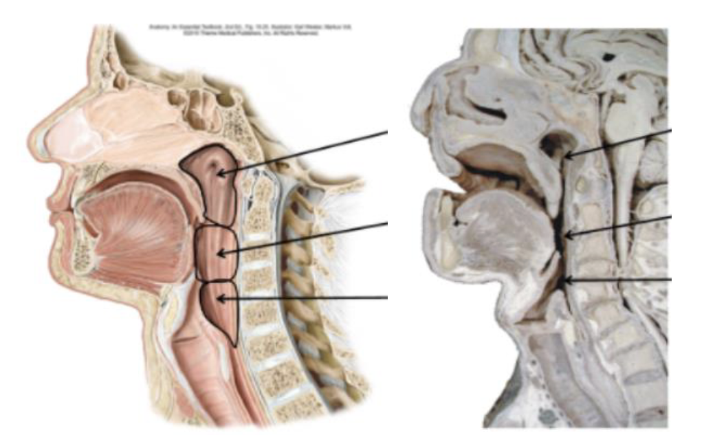 <p>identify from top to bottom</p>