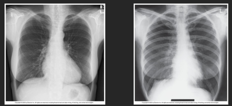 <p>determine body habitus</p>