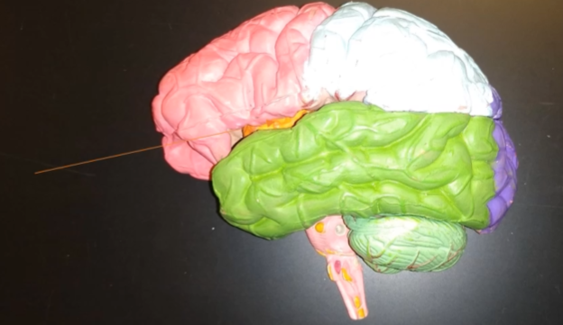 <p>What is the lobe colored in blue?</p>