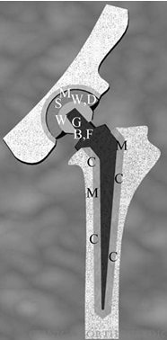 <p>what is W,D,G,B,F,C,M.S </p>