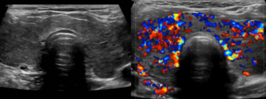 <p>Name this pathology </p>
