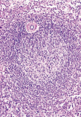 <p>Identify this structure</p>