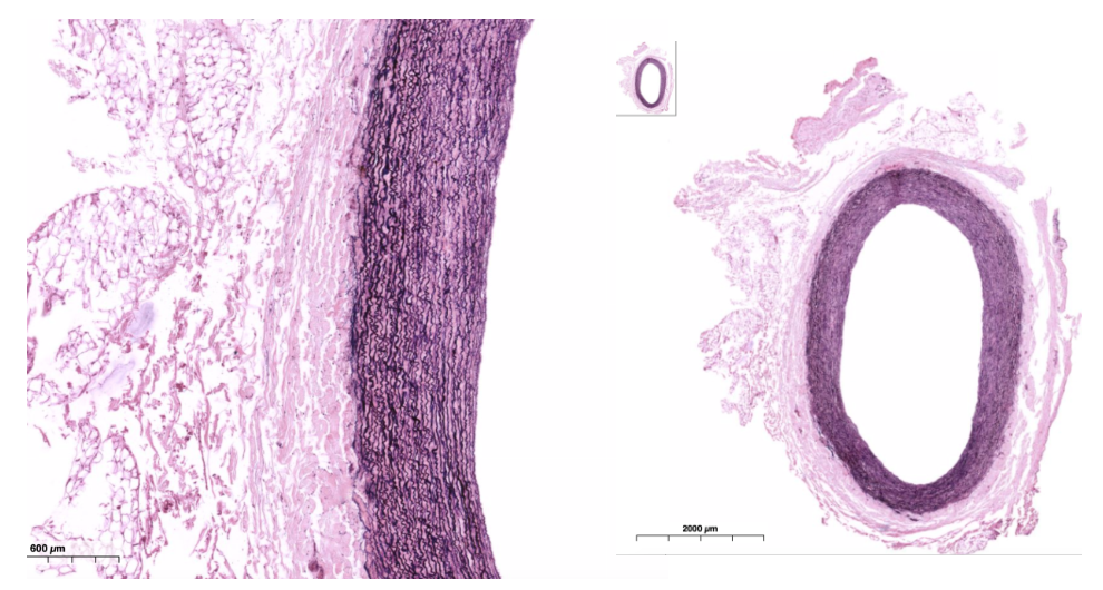 <ul><li><p>Largest; include pulmonary trunk/aorta</p><ul><li><p>Tunica media with fenestrated membranes (lamellae) elastic tissue</p><ul><li><p>Alternates with smooth muscle</p></li><li><p>Internal and external elastic membranes also present</p><ul><li><p>Allows walls to expand, then recoil to help push blood along</p></li></ul></li><li><p>Very thin tunica externa, often with vasa vasorum</p></li></ul></li></ul></li></ul><p></p>