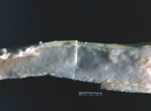 <p>nome da doenca e alteração </p>