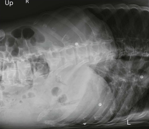 <p>Left Lateral Decub: Is this Image Good?</p>