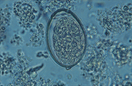 <p>What is this parasite (genus and species)?</p>