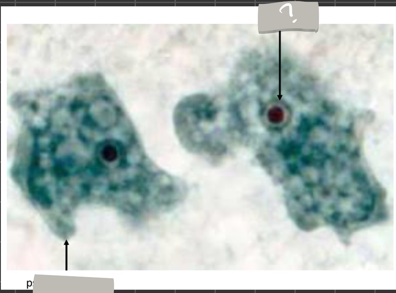 term image
