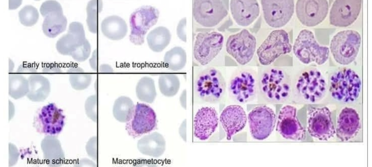 <p>-Retics infected (large RBCs)</p><p>-Ring forms >1/3 size of RBC</p><p>-Mature troph is ameboid, fills RBC</p><p>-Schizont has 12-24 merozoites</p><p>-Gametocytes are large and oval</p><p>-Schuffner’s dots</p>